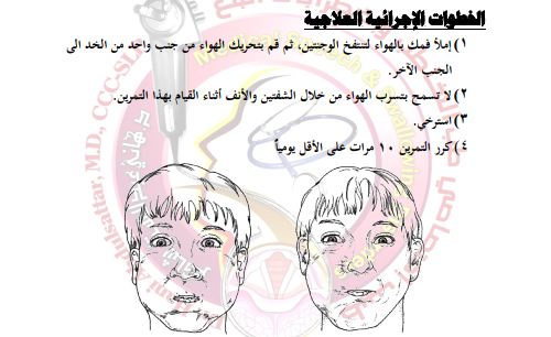 تمارين عضلات الخد